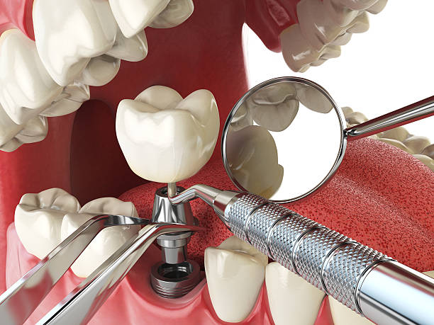 Best Urgent Tooth Repair  in Slater Marietta, SC